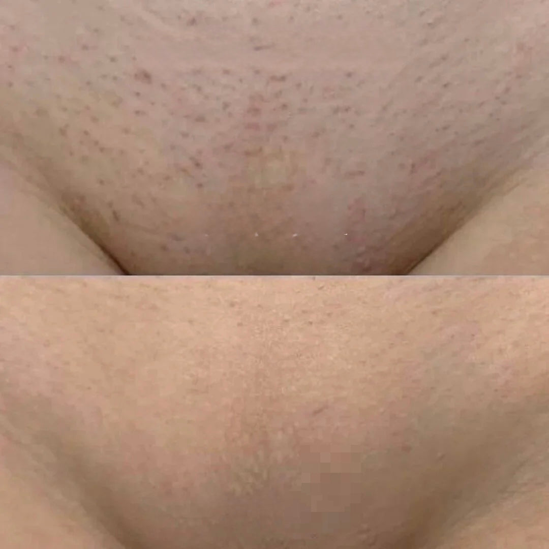 Elora™ – Luxury Women's Shaver 